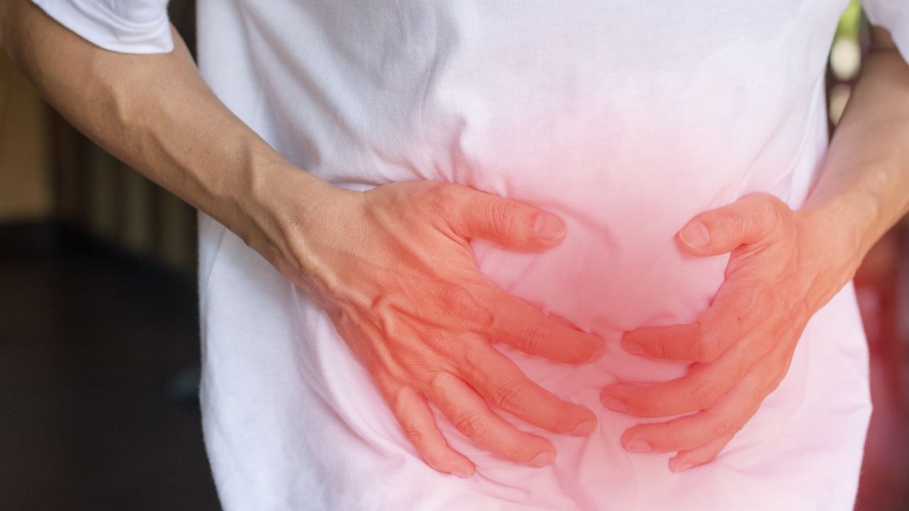 CID Hérnia Umbilical