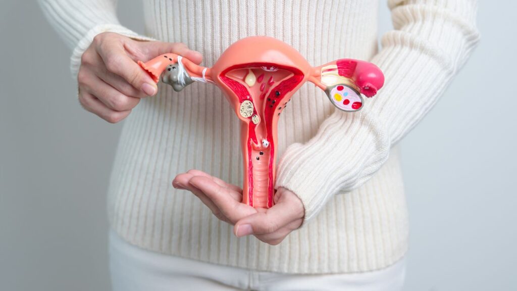 CID mioma uterino