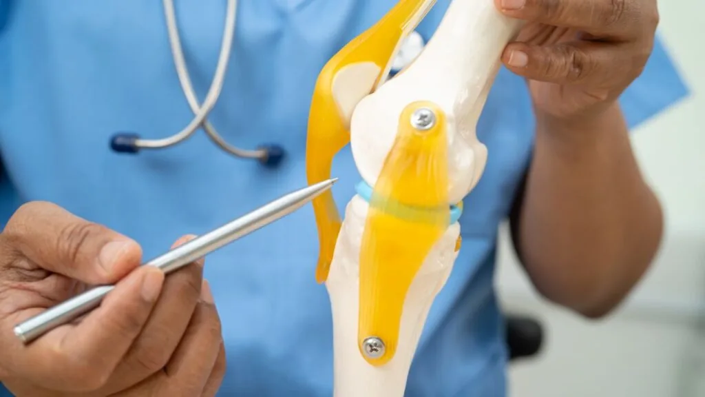 Artrose isenção imposto de renda